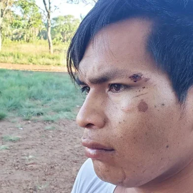 Polícia Federal abre inquérito para investigar conflito em reserva indígena no norte do RS<!-- NICAID(14646136) -->