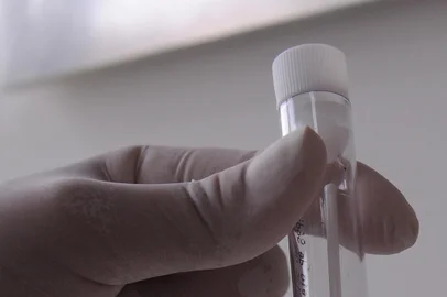  CAXIAS DO SUL, RS, BRASIL, 04/09/2020 - Laboratório Alfa faz coleta para teste de covid 19. Além de coleta de sangue, o laboratório também faz teste PCR, feito por meio de um cotonete introduzido na narina. (Marcelo Casagrande/Agência RBS)<!-- NICAID(14587968) -->