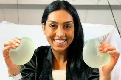 amanda djehdian, silicone, explante