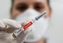 Vigilância em Saúde reforça que não há evidências de prejuízo em atraso na segunda dose da CoronaVac