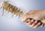 Conheça a alopecia androgenética, tipo de "calvície feminina"