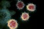 This handout illustration image obtained February 27, 2020 courtesy of the National Institutes of Health shows a transmission electron microscopic image  that shows SARS-CoV-2also known as 2019-nCoV, the virus that causes COVID-19, isolated from a patient in the US, as the Virus particles are shown emerging from the surface of cells cultured in the lab- the spikes on the outer edge of the virus particles give coronaviruses their name, crown-like. - President Donald Trump has played down fears of a major coronavirus outbreak in the United States, even as infections ricochet around the world, prompting a ban on pilgrims to Saudi Arabia. China is no longer the only breeding ground for the deadly virus as countries fret over possible contagion coming from other hotbeds of infection, including Iran, South Korea and Italy. There are now more daily cases being recorded outside China than inside the country, where the virus first emerged in December, according to the World Health Organization. (Photo by Handout / National Institutes of Health / AFP) / RESTRICTED TO EDITORIAL USE - MANDATORY CREDIT AFP PHOTO /NATIONAL INSTITUTES OF HEALTH/NIAID-RML/HANDOUT  - NO MARKETING - NO ADVERTISING CAMPAIGNS - DISTRIBUTED AS A SERVICE TO CLIENTSEditoria: HTHLocal: WashingtonIndexador: HANDOUTSecao: healthcare policyFonte: National Institutes of HealthFotógrafo: Handout<!-- NICAID(14435482) -->