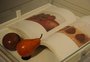 Exposição resgata memórias do convívio do médico caxiense Ely Andreazza com artista suíça