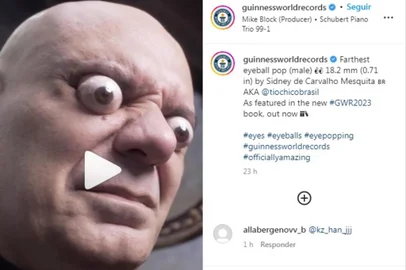 *A PEDIDO DE NIKOLAS MONDADORI* Sidney de Carvalho Mesquita, o Tio Chico, entra para o Guinness World Record ao ter o olho mais saltado do mundo - Foto: Guinness World Records @guinnessworldrecords/Instagram/Reprodução<!-- NICAID(15241517) -->
