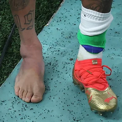 Picture of the swollen ankle of Brazils forward #10 Neymar taken as he leaves the field at the end of the Qatar 2022 World Cup Group G football match between Brazil and Serbia at the Lusail Stadium in Lusail, north of Doha on November 24, 2022. (Photo by Giuseppe CACACE / AFP)Editoria: SPOLocal: DohaIndexador: GIUSEPPE CACACESecao: soccerFonte: AFPFotógrafo: STF<!-- NICAID(15275766) -->