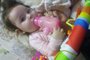 Emanuela Castanho Gasperin, 1 ano e dois meses, tem atrofia muscular espinhal (AME) do tipo 1<!-- NICAID(15289805) -->